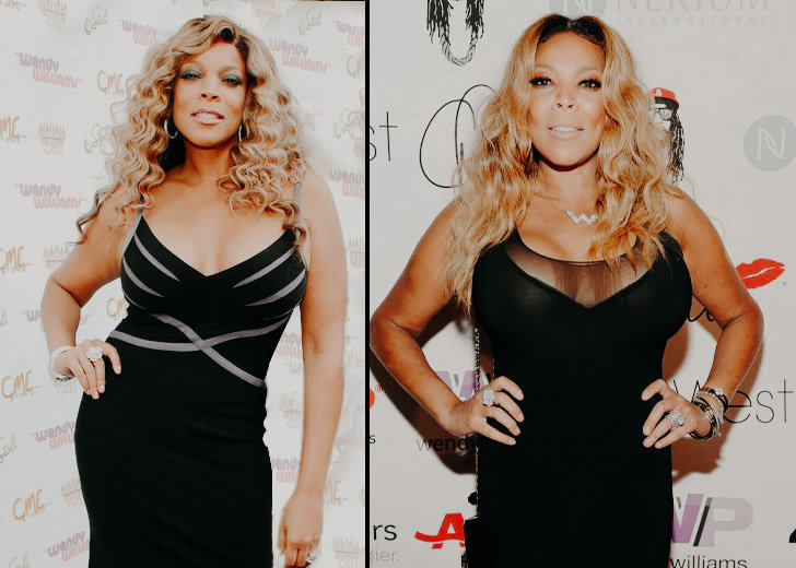 A comparison of Wendy Williams’ appearance before and after surgery shows how it has changed over the years.